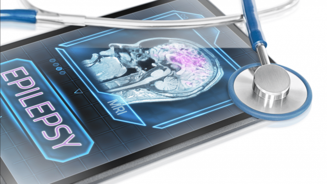 Epilepsy 101 by Neurologist Nilaya Bhawsar